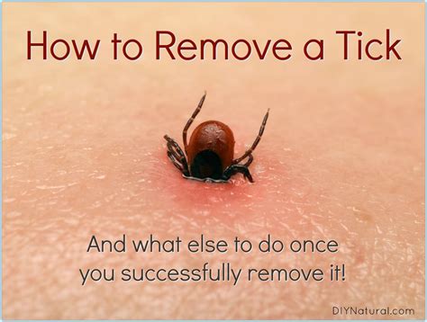 Expert Tips for Effective Tick Removal