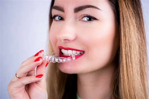 Exploring Alternative Options: Clear Aligners and Lingual Braces