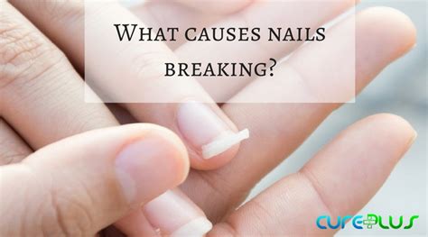 Exploring Common Meanings Behind Dreams Involving Nail Breakage