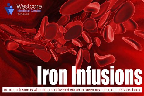 Exploring Different Methods of Iron Fusion