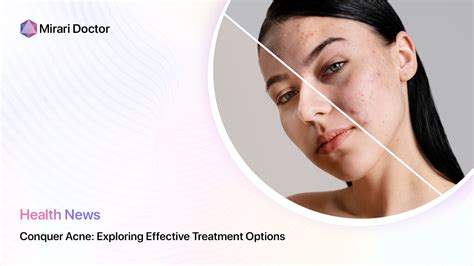 Exploring Effective Options for Treating Acne: Over-the-Counter to Prescription