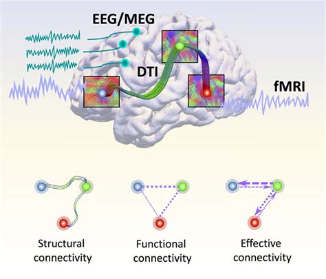 Exploring Revolutionary Research on Brain Connectivity