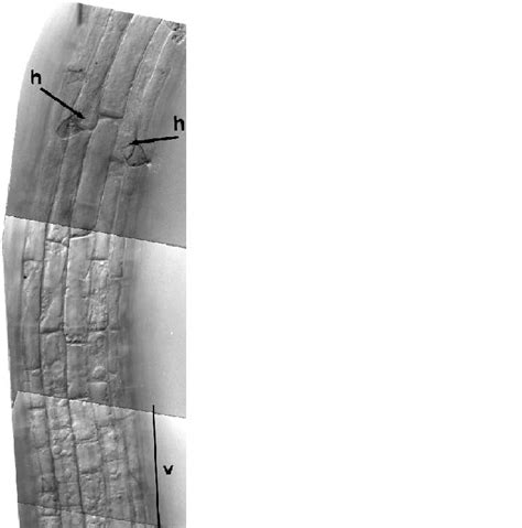 Exploring Various Meanings of Visions Depicting Weeds Emerging from the Epidermis