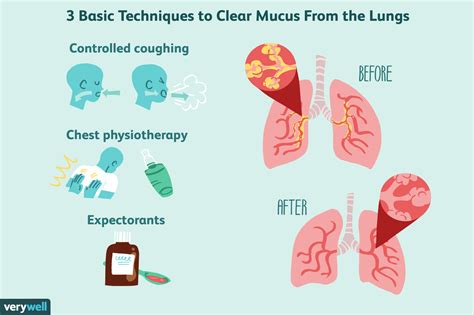 Exploring the Association Between Smoking and Excessive Mucus Buildup