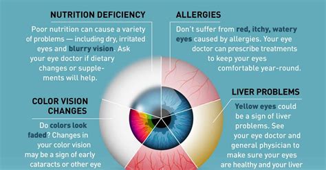 Exploring the Connection: Eye-Related Medical Conditions and their Association with Eye Swelling