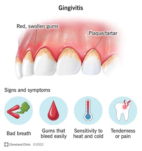 Exploring the Connections between Physical Health and the Symptoms of Sensitive Gums