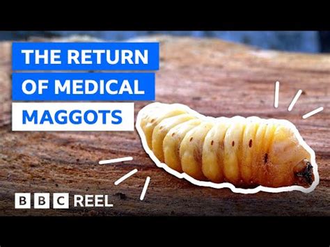 Exploring the Disturbing Imagery of Maggots Exiting a Digit