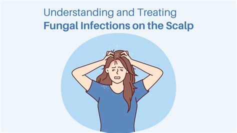 Exploring the Fundamentals: Gaining Insight into Scalp Infections