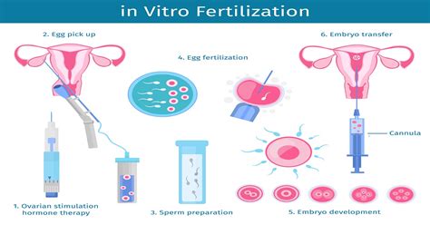 Exploring the Journey of Fertility Treatments