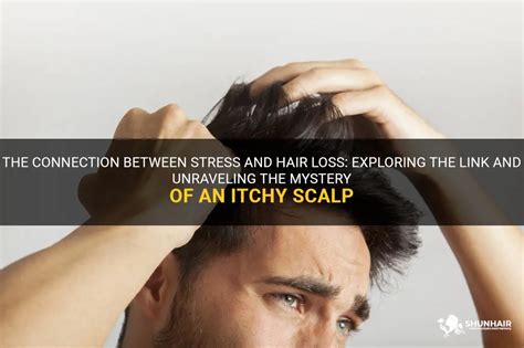 Exploring the Link Between Stress and Scalp Wellness