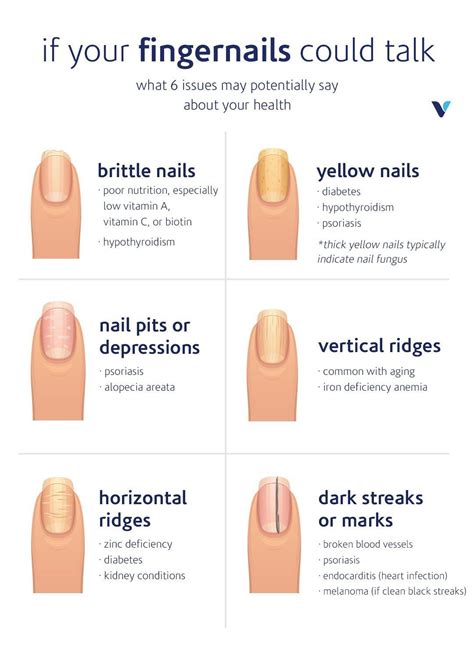 Exploring the Link between Physical Discomfort and Symbolism in Dreams: A closer look at the relationship between the health of our nails and dream interpretation