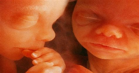 Exploring the Possible Real-Life Implications of Envisioning Unborn Twins