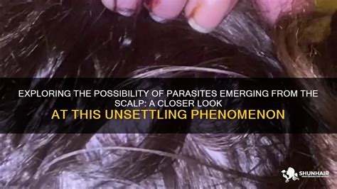 Exploring the Potential Causes of Unsettling Sensations: A Journey from Parasites to Psychosis