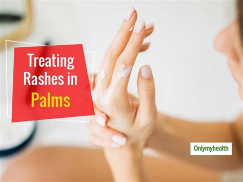 Exploring the Potential Factors Behind Experiencing a Dismembered Injury on One's Palm