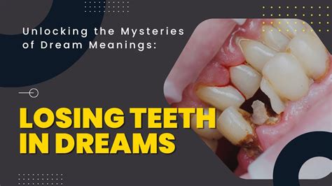 Exploring the Potential Real-Life Significance of Losing Multiple Teeth in Dreamscapes