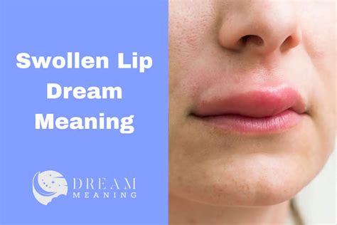 Exploring the Potential Significance of Dreaming about a Swollen Lower Lip