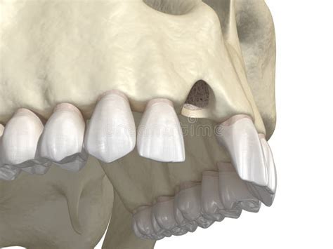 Exploring the Psychological Significance of Dreams about Unsteady Upper Incisors