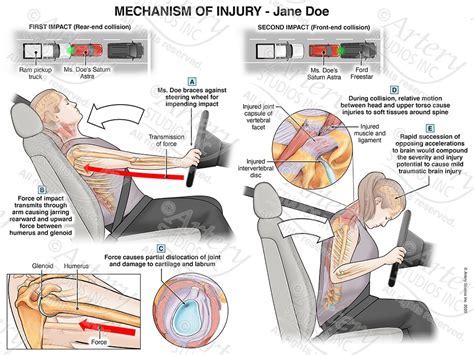 Exploring the Psychological Significance of Observing a Harrowing Vehicle Collision in Dreams