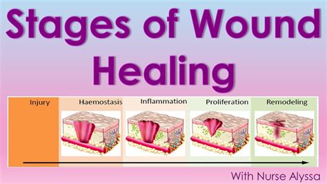 Exploring the Role of Wound Healing in Personal Growth and Transformation