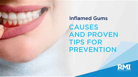 Exploring the Root Causes and Meanings Behind Inflamed Oral Cavity Visions