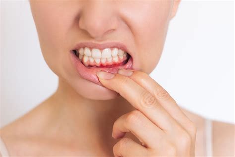 Exploring the Underlying Factors of Tooth Swelling: Beyond Inadequate Oral Care