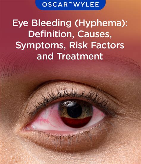 Factors Behind Oral Hemorrhaging in Night visions