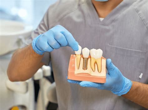 Factors to Consider: Are You a Suitable Candidate for Dental Implants?