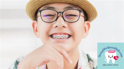 Frequently Asked Questions About Oral Braces