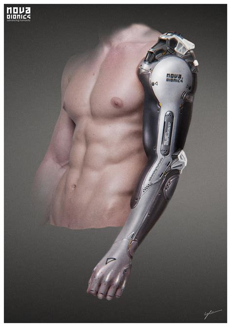 From Science Fiction to Reality: Bionic Arms that Can Feel