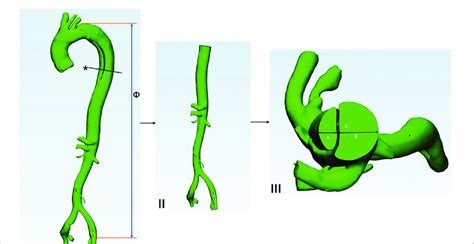 Height: Dissecting the Model's Vertical Measurement