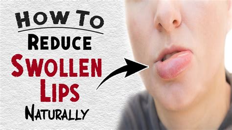 Home Remedies for Soothing and Reducing Swollen Lips