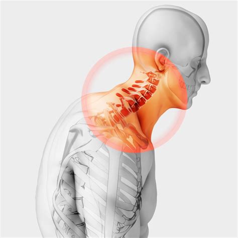 Identifying Underlying Health Issues that Contribute to Neck Discomfort