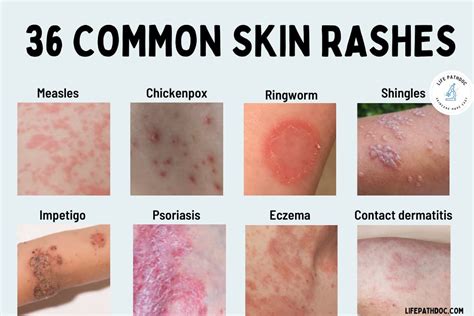 Identifying the Common Causes of Facial Rashes