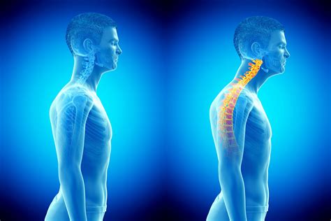 Improving Alignment and Posture for Optimal Body Support