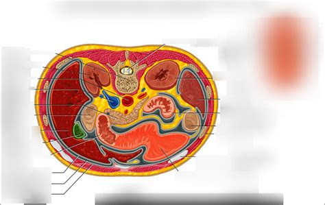 Interpreting the Presence of Worms Emerging from the Abdominal Cavity in Various Scenarios