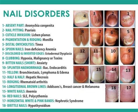 Interpreting the Symbolic Significance of Another Individual's Nail Bed Manifestations