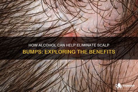 Investigating Physical Health: Exploring Dreams about Bumps on the Scalp