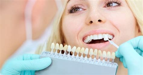 Is Professional Teeth Whitening Worth It?