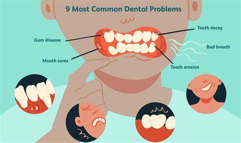 Learning from Experience: How to Prevent Future Dental Concerns