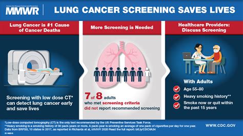 Lung Cancer Screening: Assessing Your Risk Level