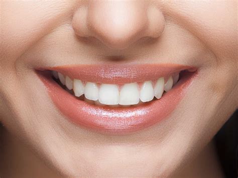 Maintaining Your Ideal Smile