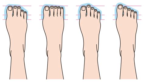 Managing Toenail Length: Trust the Experts