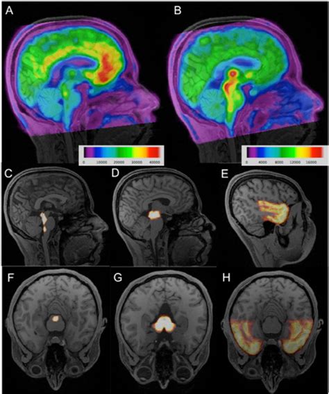 Medical Explanations: Examining the Physical Underpinnings of Experiencing Sudden, Auditory Disturbances during Sleep