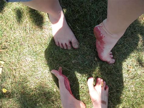 Methods for Analyzing and Decoding Dreams about Bloodied Toes