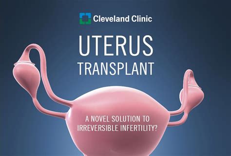 Miracle of Science: The Potential for Uterine Transplantation