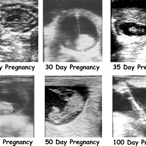 Mirroring Life's Stages: Pregnancy and Ultrasound Symbolism