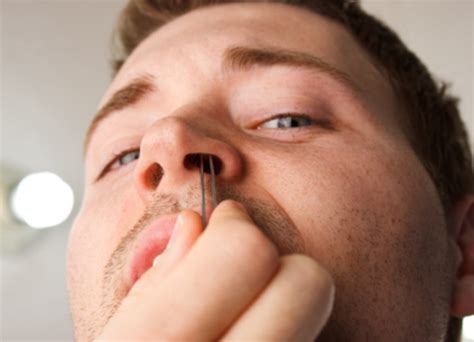 Nasal Hair Extraction: A Surprising Dream Symbol