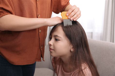 Natural Solutions for Lice: Exploring Alternative Measures