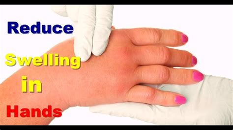 Natural Ways to Alleviate Thumb Inflammation