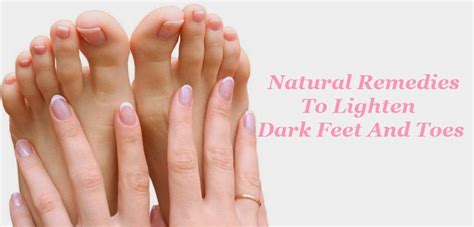 Naturally Lighten Your Nails: Effective Home Remedies for Brighter Nail Appearance